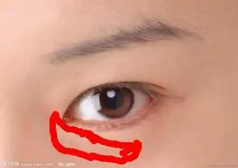 下眼皮这个部位有细纹,还略带点点黑紫色,是没睡好吗?怎么改善?