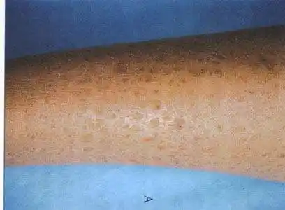 缓解鱼鳞病要经常吃维生素