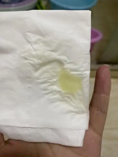 有人自己买过显微镜看白带吗