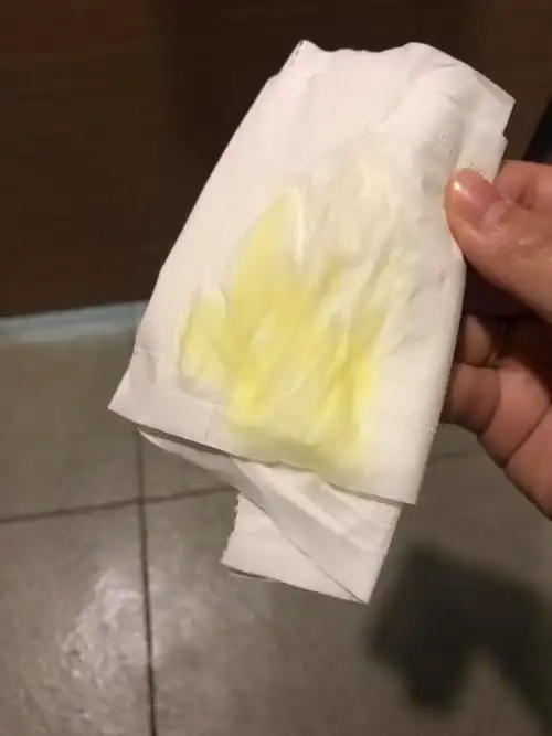 有尿液那么黄的吗?感觉像花生油一样的颜色,纸巾上就像荧光黄色