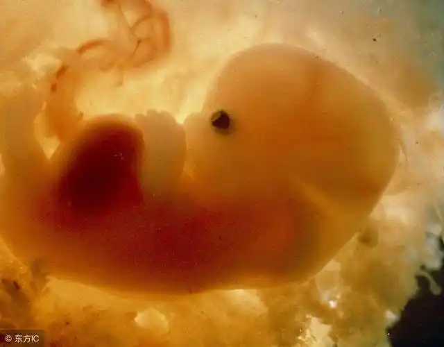 他说:戴tt就像穿袜子洗脚,为此她三个月人流两次