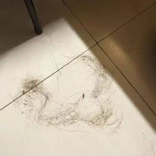 听说你与脱发有一段缘_头发