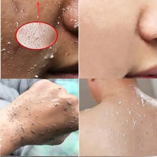 去角质男士死皮面部祛痘印啫喱女脏脸部全身体去鸡磨砂膏深层清洁