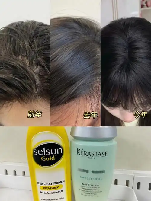 油性发质这些年实录,洗发水不要大意选!