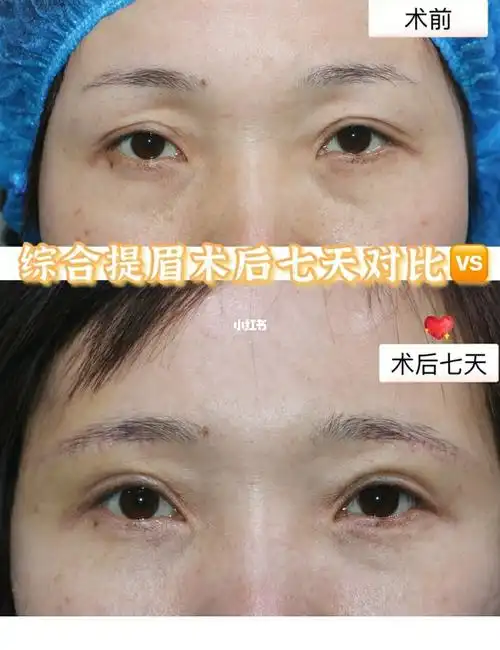 1080_1405竖版 竖屏