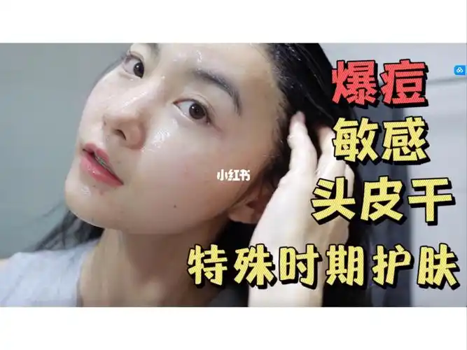 头皮护理比护肤重要敏感肌肤看过来