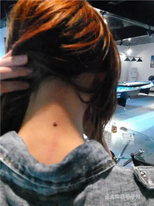 痣相:脖子后面的「苦情痣」有着怎样的运势?你有没有这颗痣?