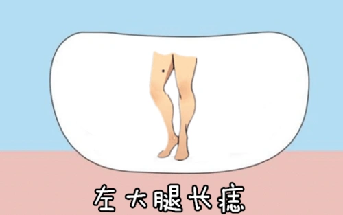 左大腿长痣在相学当中,若是一个人的左腿的位置处长有吉痣,则他们天生