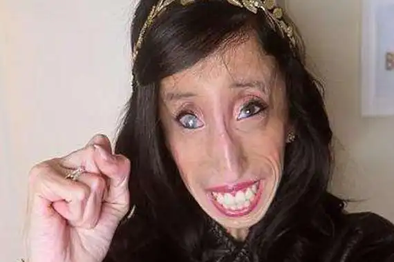 世界上最丑陋的女人20岁干瘦如老太全身几乎零脂肪