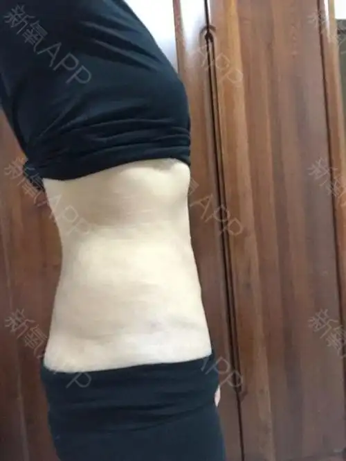 的还挺快的,效果也很满意,就是塑形衣,还得继续穿,下面给你们看照片