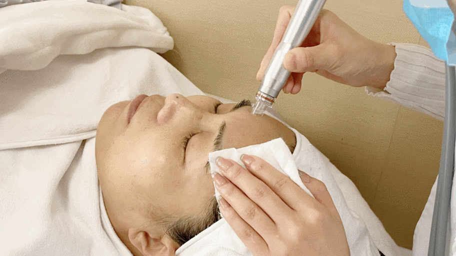 小气泡清洁是否能改善脸部油痘肌,这种医美有什么优势?