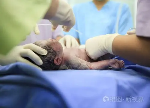 初生婴儿在劳动室