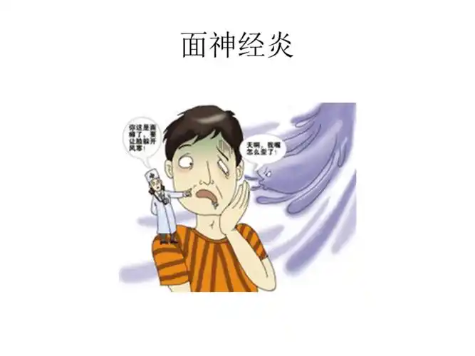 医科大学精品课件面神经炎理疗