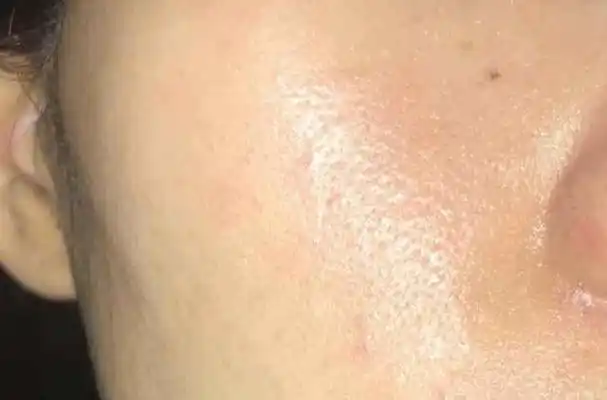 面部出油严重,不要慌张,教你解决脸部出油!备上这件洁面神器