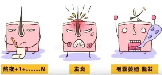 患有毛囊炎该怎么办?用什么办法才能治得好?