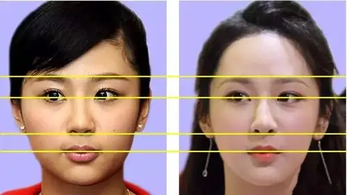 杨紫5年整了4次,连整容医院都被网友扒出来了