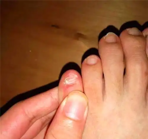 如果你脚趾有这个特征那你可能不是正宗汉族人而是鲜卑人后代