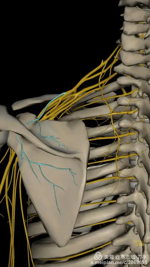 肩胛上神经卡压综合征