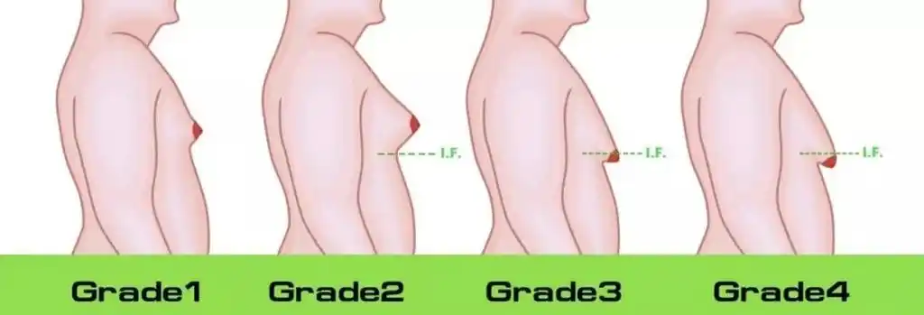 男人的"咪咪"有用吗?长到c罩杯好吗?