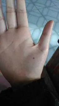 手腕有痣的女人