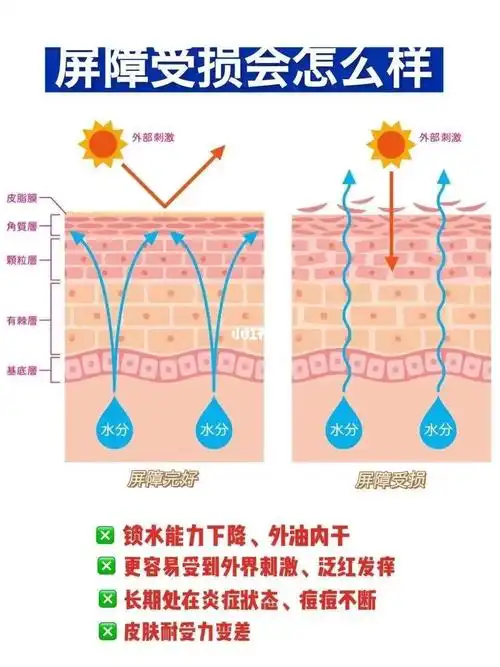到底什么是皮肤屏障受损该怎么办看这里