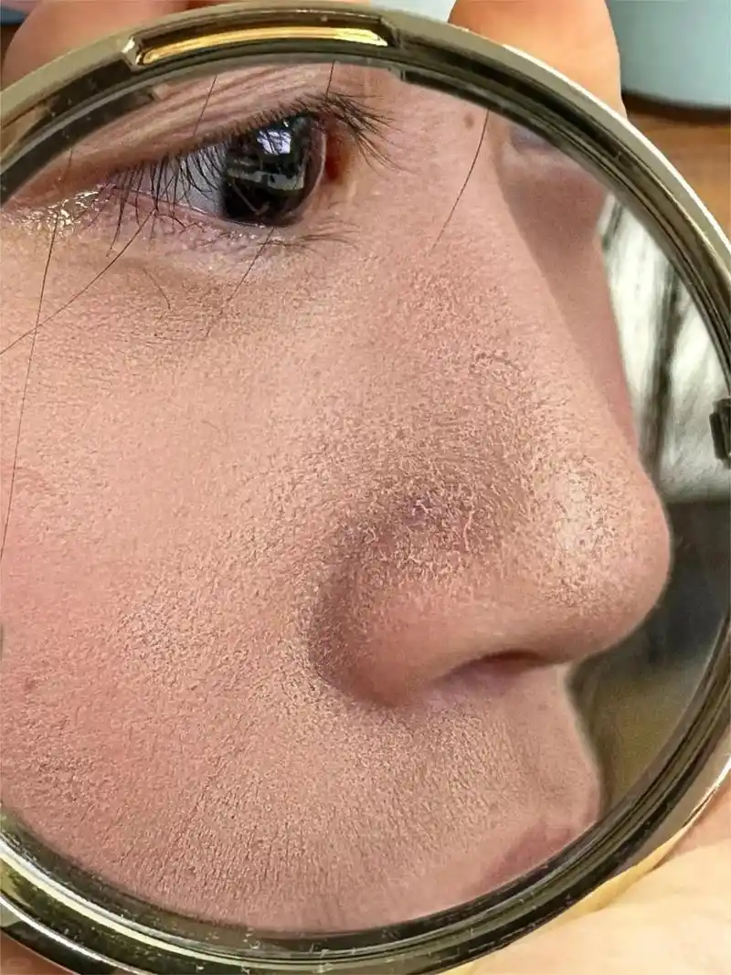 脸上长纹纹,皮肤干燥粗糙缺水,显得老.那就试试这个#白云山烟 - 抖音