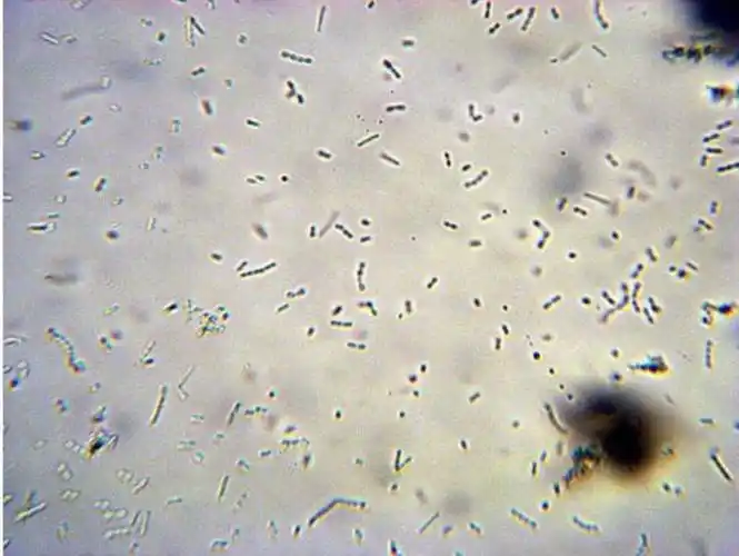 显微镜下的手部细菌