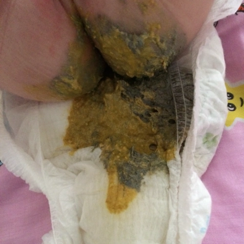 这是宝宝今天便便的照片