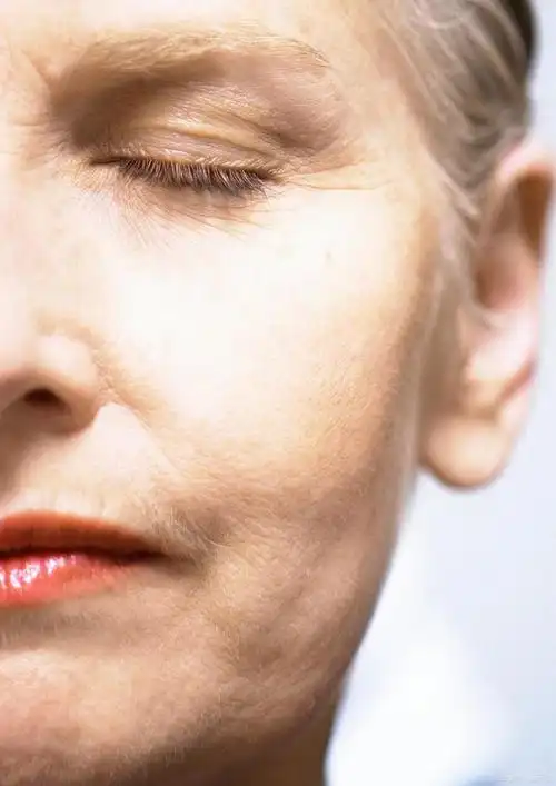 皮肤松弛怎么办如何变紧致?这几个抗衰项目了解下!