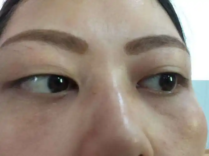 最近经常加班熬夜,黑眼圈,眼袋太重,脸也变黄了怎么办