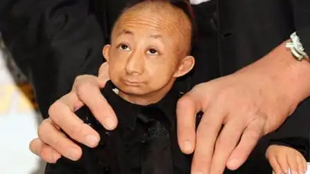 世界上最小的人: 身高50公分, 体重只有4.5千克