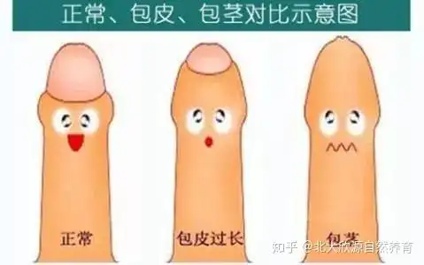 欣源说坏了坏了小小男孩包皮过长包茎包皮要割吗