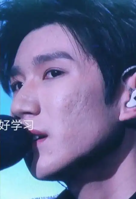 王源电影节红毯状态翻车,浓妆掩盖不住痘坑,眼神憔悴显沧桑