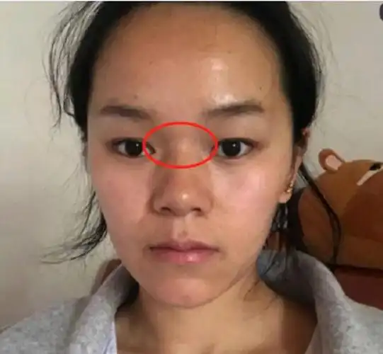 面相上看;女人山根有横纹皱纹好不好?