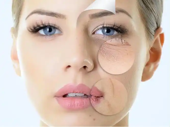 干性皮肤怎么保养才好(皮肤紧绷干燥!干性肌肤应该如何护理?