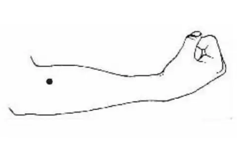 右手臂有痣图解大全