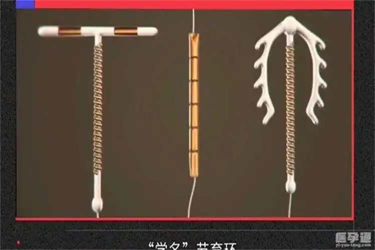 专家为什么不建议女人上环不能绝对避孕还会带来这些伤害