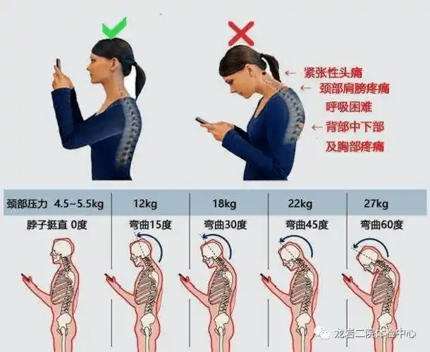 现代社会引起脖子前倾的原因有3个:低头玩手机,枕头不适合,背部肌肉不