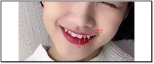 宝宝长虎牙的寓意