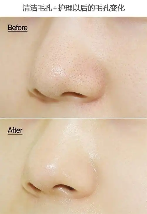 2015新款悦诗风吟火山泥慕斯毛孔清洁面膜的用法