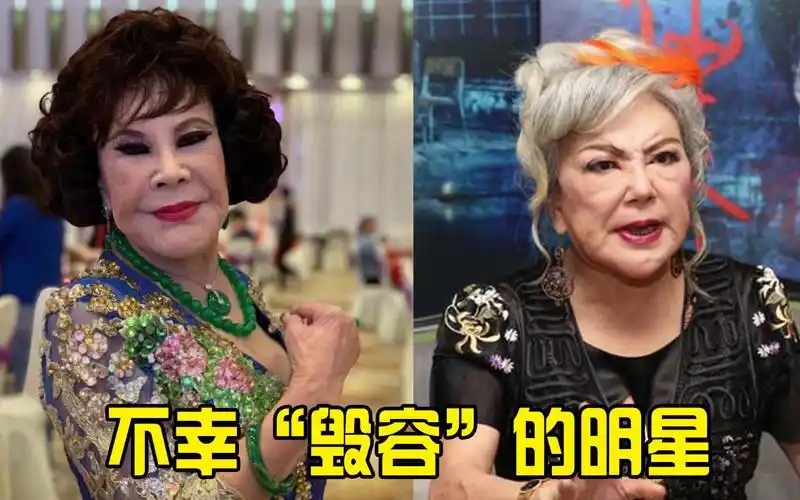 不幸毁容的明星,邵音音黄夏蕙曾吓跑小偷,胡歌阿娇令人感到惋惜