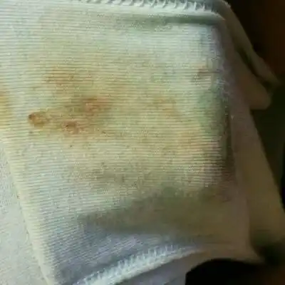 情况下白带是无色无味的,而且有轻微的粘稠,有的女性白带是乳白色的