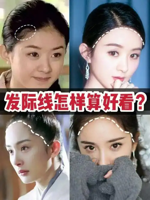 怎么样的发际线才算好看