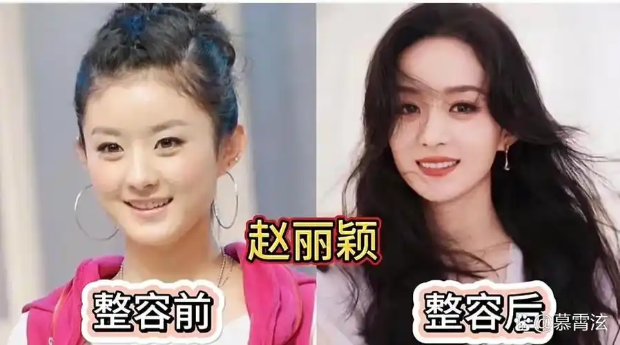 第九位:孙菲菲#明星# #娱乐赵丽颖整容前赵丽颖整容 对比 前后赵丽颖