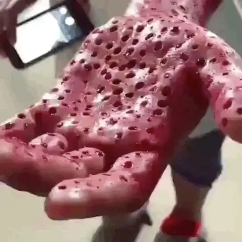 有哪些让人产生密集恐惧的照片?