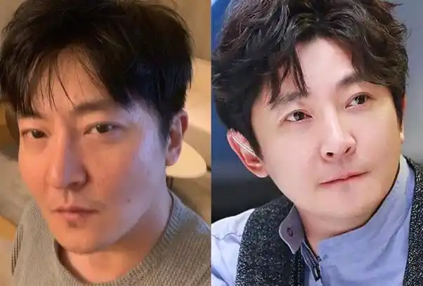 郭京飞录节目中途离场,自曝刚刚割完眼袋,网友赞其太过耿直!