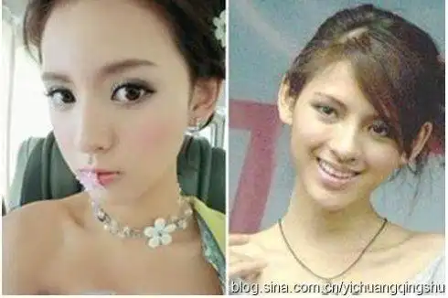 王思聪21岁女友张予曦旧照曝光被疑整容