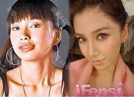 郑爽姚笛整形后照片曝光盘点女星整容前后对比照(图)近日,郑爽整容的