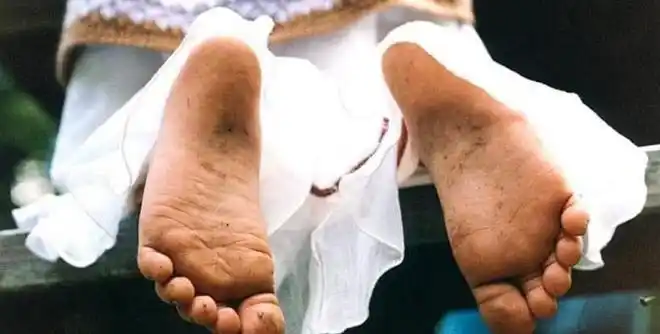 为什么有些人的脚会发臭有的人却丝毫没有味道万万没想到