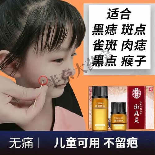 点斑无痕无痛水去痦子痣脱痣去脸上的黑痣贴 点痣水一瓶点痣点斑工具